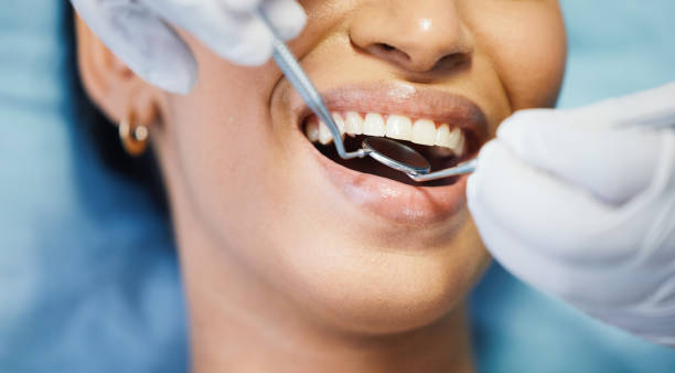 Best Emergency Dentist for Knocked-Out Tooth in Frenchtown, NJ